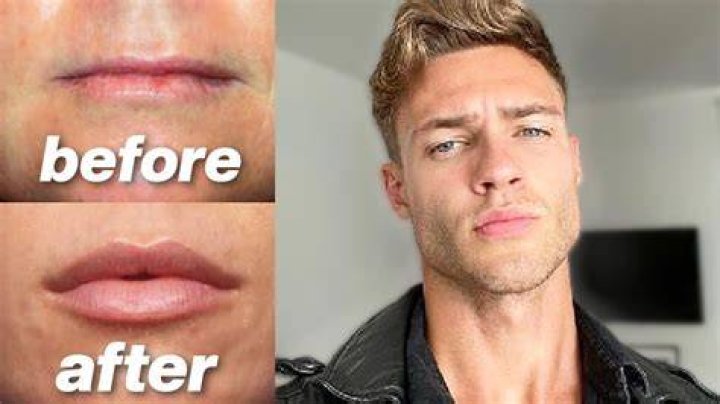 Do guys like plump lips?