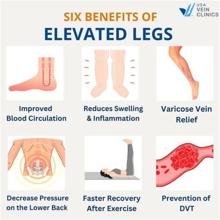 Does elevating legs prevent blood clots?
