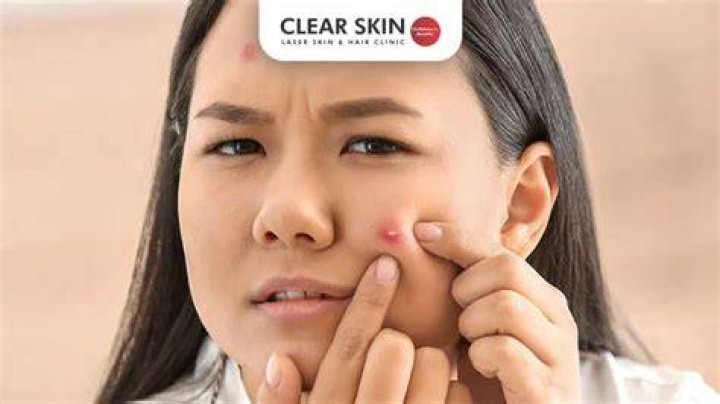 Why do I keep getting blind pimples?
