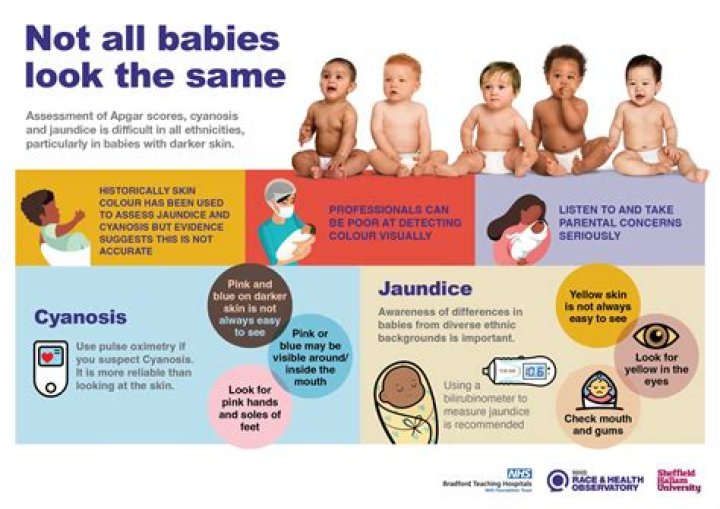 Why do newborns stare?